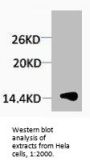 Tri-Methyl-Histone H1 (Lys25) Antibody