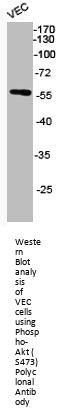 Phospho-AKT1/AKT2/AKT3 (S473) Antibody