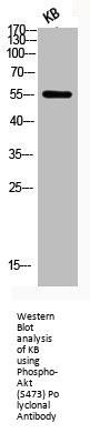 Phospho-AKT1/AKT2/AKT3 (S473) Antibody
