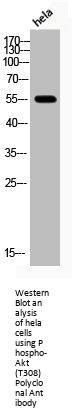 Phospho-AKT1/AKT2/AKT3 (T308) Antibody