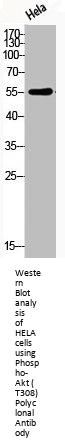 Phospho-AKT1/AKT2/AKT3 (T308) Antibody