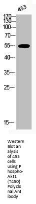 Phospho-AKT1 (T450) Antibody