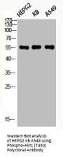 Phospho-AKT1 (T450) Antibody