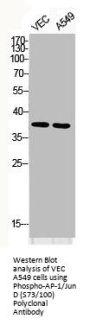 Phospho-JUN/JUND (S73/100) Antibody