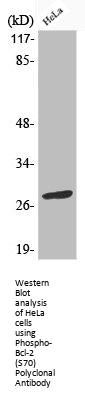 Phospho-BCL2 (S70) Antibody