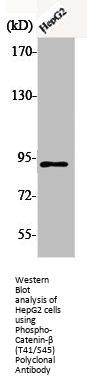 Phospho-CTNNB1 (T41/S45) Antibody