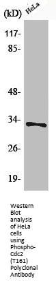 Phospho-CDK1 (T161) Antibody