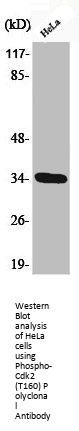 Phospho-CDK2 (T160) Antibody
