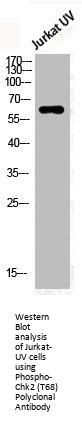 Phospho-CHEK2 (T68) Antibody