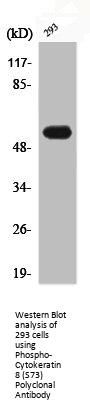 Phospho-KRT8 (S73) Antibody