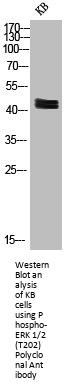Phospho-MAPK3/MAPK1 (T202) Antibody
