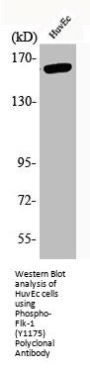 Phospho-KDR (Y1175) Antibody
