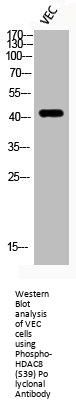 Phospho-HDAC8 (S39) Antibody