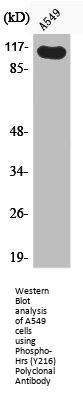 Phospho-HGS (Y216) Antibody