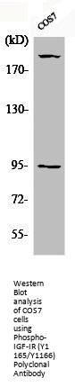 Phospho-IGF1R (Y1165/Y1166) Antibody