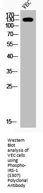 Phospho-IRS1 (S307) Antibody
