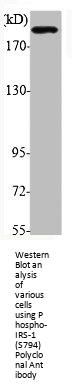 Phospho-IRS1 (S794) Antibody