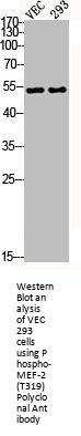 Phospho-MEF-2 (T319) Polyclonal Antibody