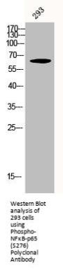 Phospho-RELA (S276) Antibody