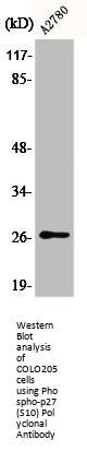 Phospho-CDKN1B (S10) Antibody