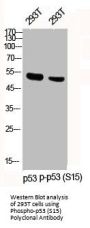 Phospho-TP53 (S15) Antibody
