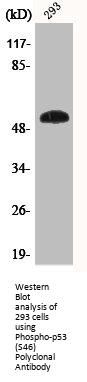 Phospho-TP53 (S46) Antibody