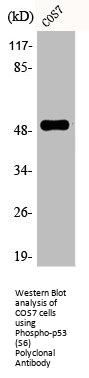 Phospho-TP53 (S6) Antibody