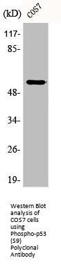 Phospho-TP53 (S9) Antibody