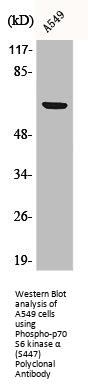 Phospho-RPS6KB1 (S447) Antibody