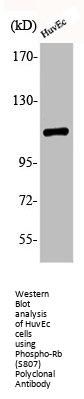 Phospho-RB1 (S807) Antibody