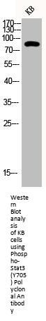 Phospho-STAT3 (Y705) Antibody