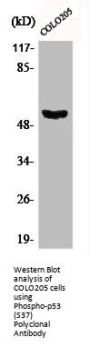 Phospho-TP53 (S37) Antibody