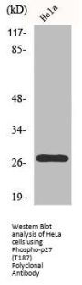 Phospho-CDKN1B (T187) Antibody