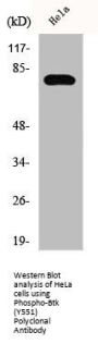 Phospho-BTK (Y551) Antibody