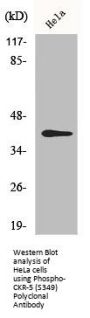 Phospho-CCR5 (S349) Antibody
