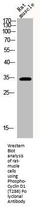 Phospho-CCND1 (T286) Antibody
