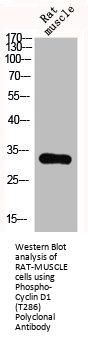 Phospho-CCND1 (T286) Antibody