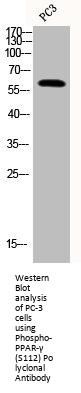 Phospho-PPARG (S112) Antibody