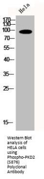 Phospho-PRKD2 (S876) Antibody