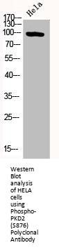 Phospho-PRKD2 (S876) Antibody