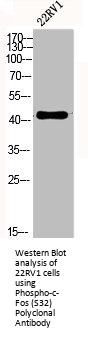 Phospho-FOS (S32) Antibody