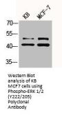 Phospho-MAPK1/MAPK3 (Y222/205) Antibody