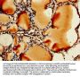 RPL11 Antibody