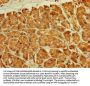 RPL11 Antibody