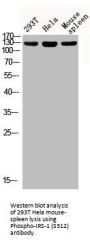 Phospho-IRS1 (S312) Antibody