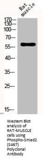 Phospho-SMAD2 (S467) Antibody