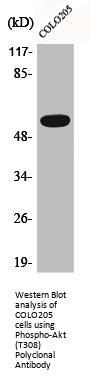 Phospho-AKT1/AKT2/AKT3 (T308) Antibody
