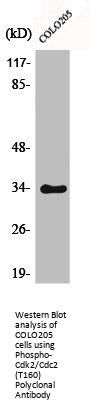 Phospho-CDK2 (T160) Antibody