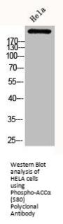 Phospho-ACACA (S80) Antibody