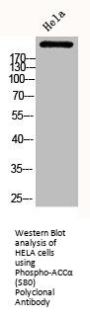 Phospho-ACACA (S80) Antibody
